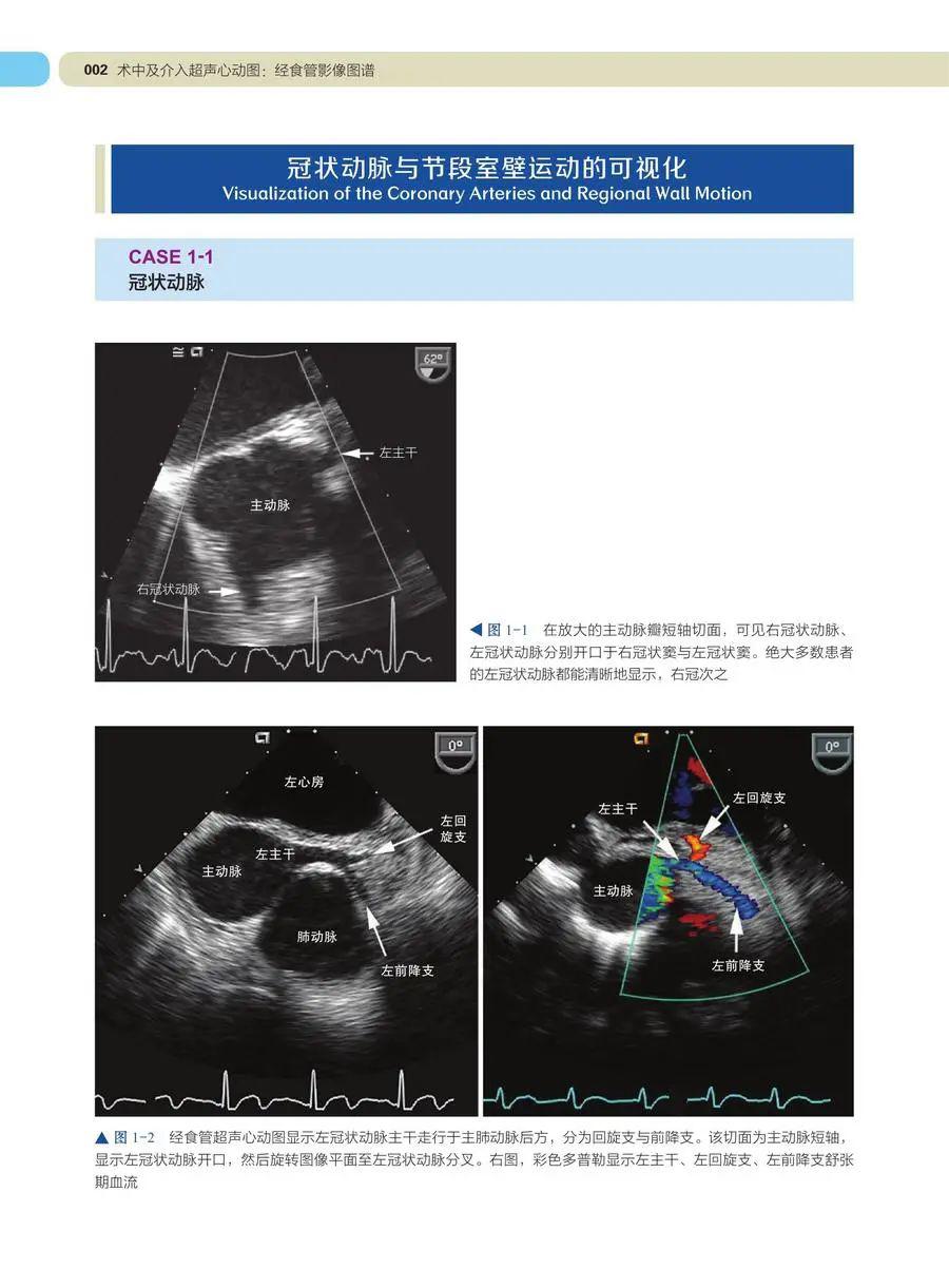 学习tee必备术中及介入超声心动图经食管影像图谱第2版
