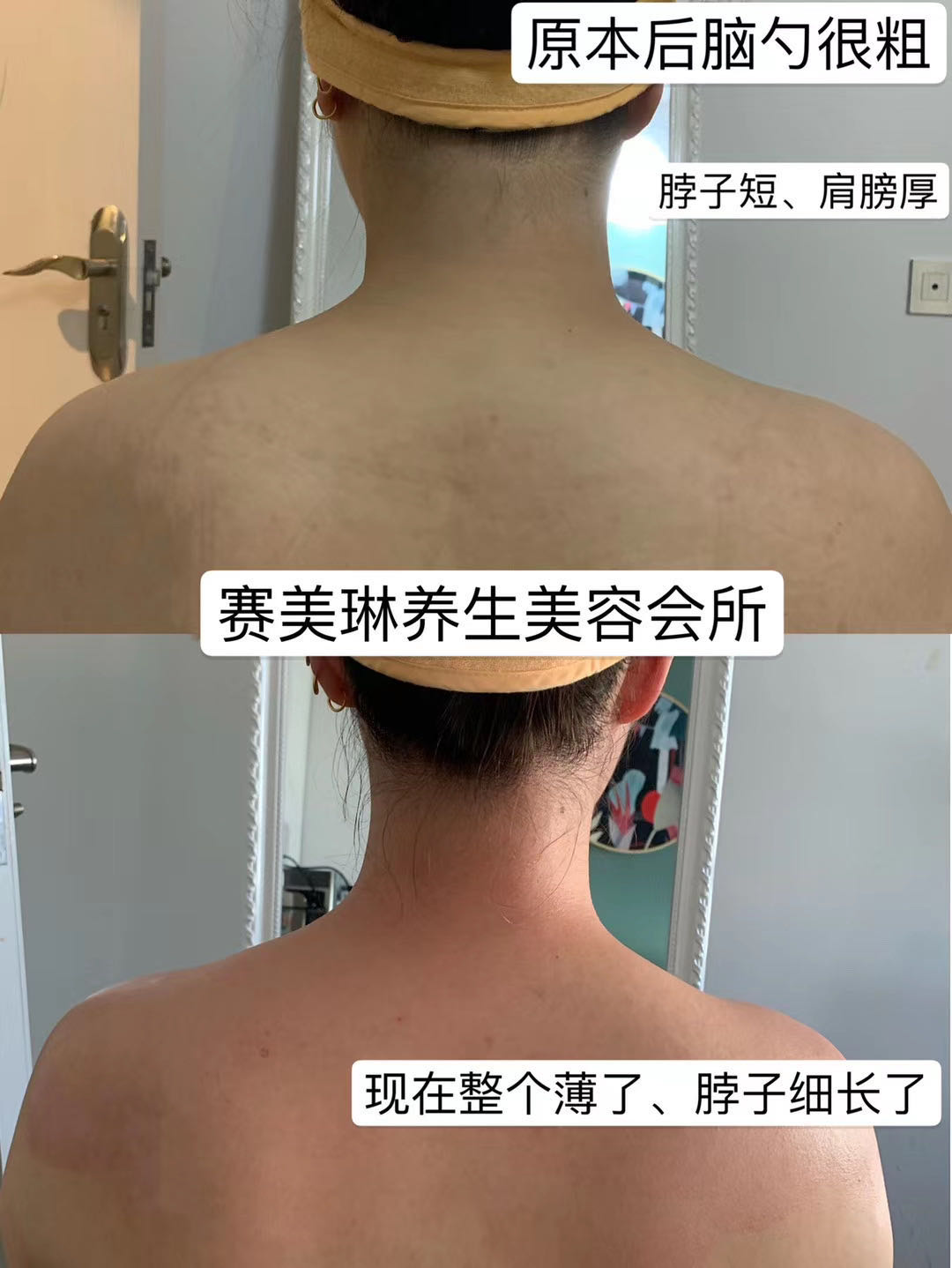 疏通肩颈的六大好处,不得不看