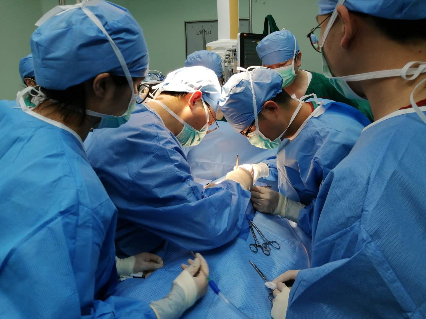 省妇幼小儿神经外科成功完成首例手术今年2月,家人发现刚出生的平平