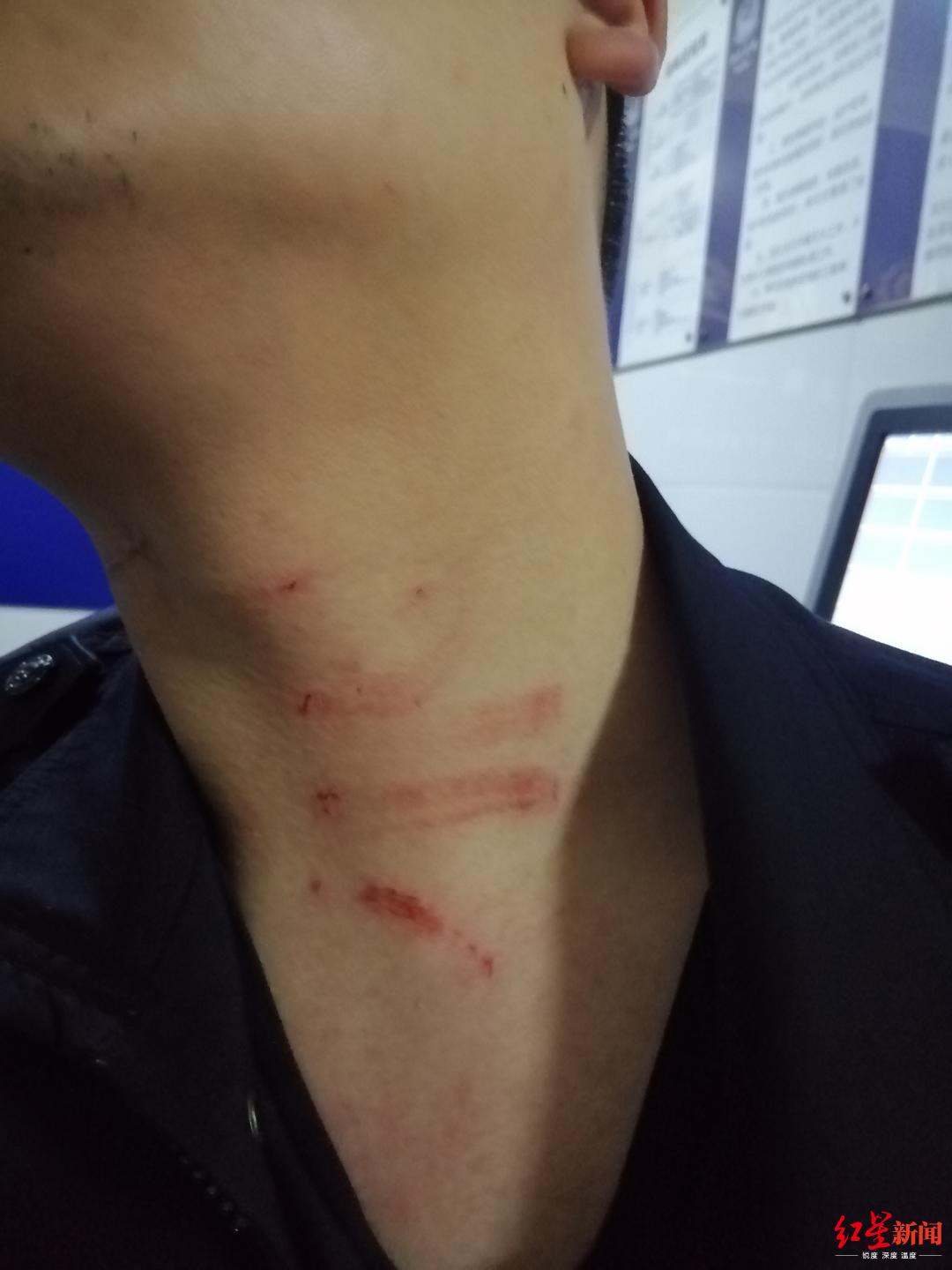 女子耍泼拿条凳打民警 暴力袭警被采取刑事强制措施