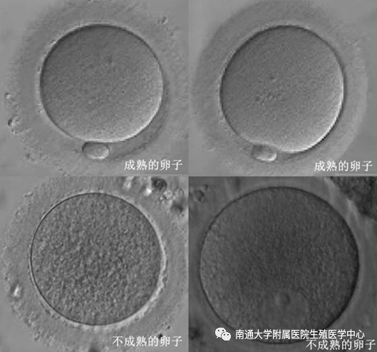 但有研究表明,颗粒细胞的表现和卵母细胞的减数分裂成熟进程不完全