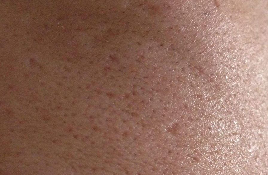 你的毛孔为什么这么大?_皮肤