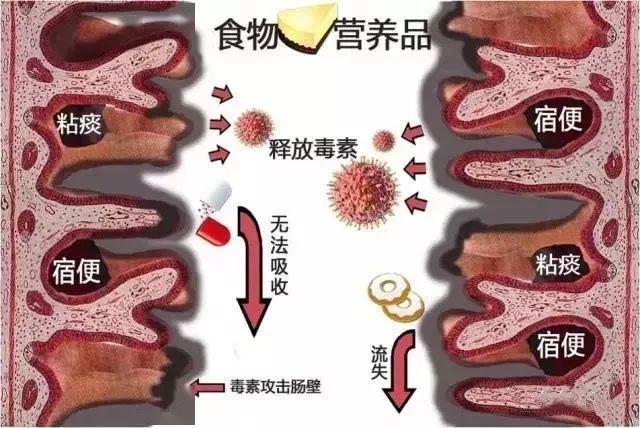 艾灸这个解毒大穴才能真正排除毒素保护肾脏健康
