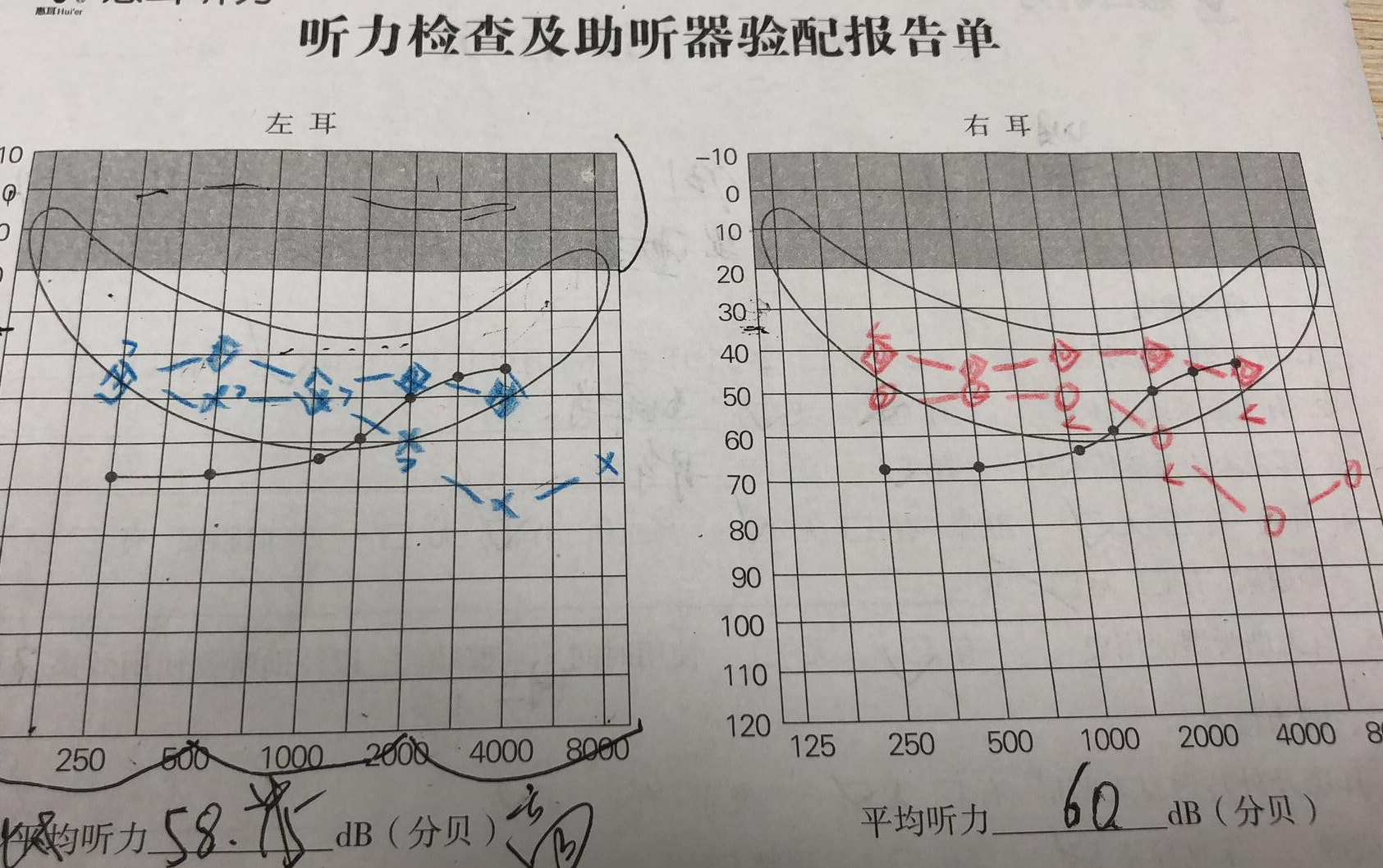 airpods听力图图片