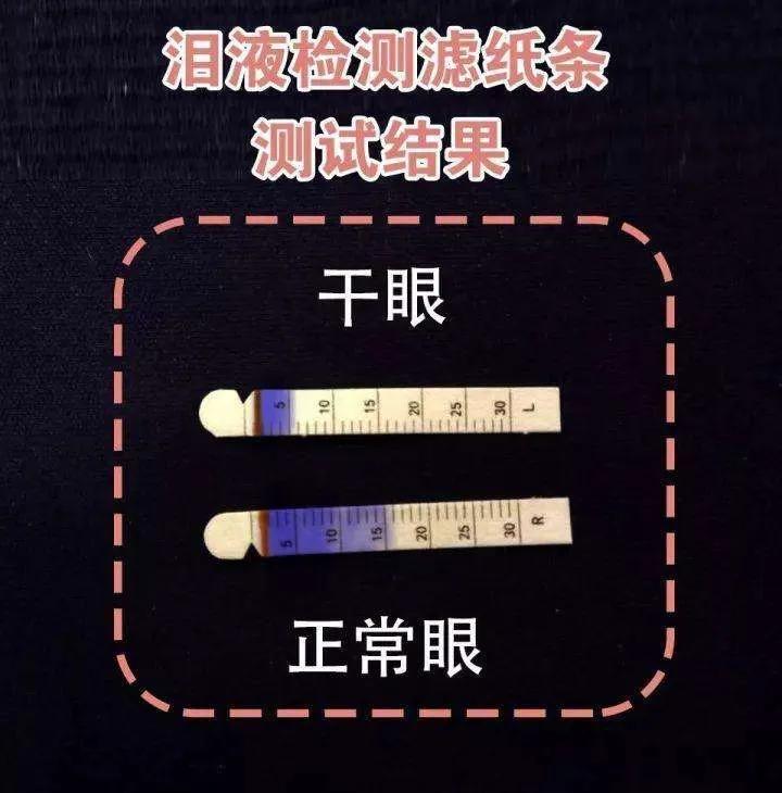 稳定性,可以通过schirmer试纸以及在裂隙灯下观察泪膜破裂时间来判断