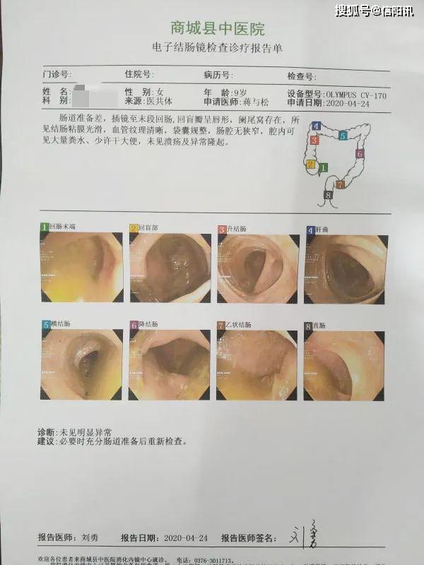 因长期便秘,大便形状改变来商城县中医院拟行无痛肠镜检查,经过内镜