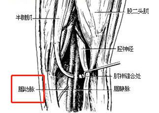 膎动静脉解剖图片图片