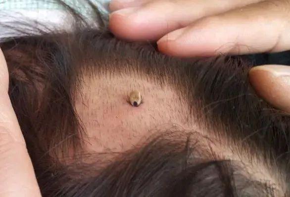 注意严重可致命已多人被咬