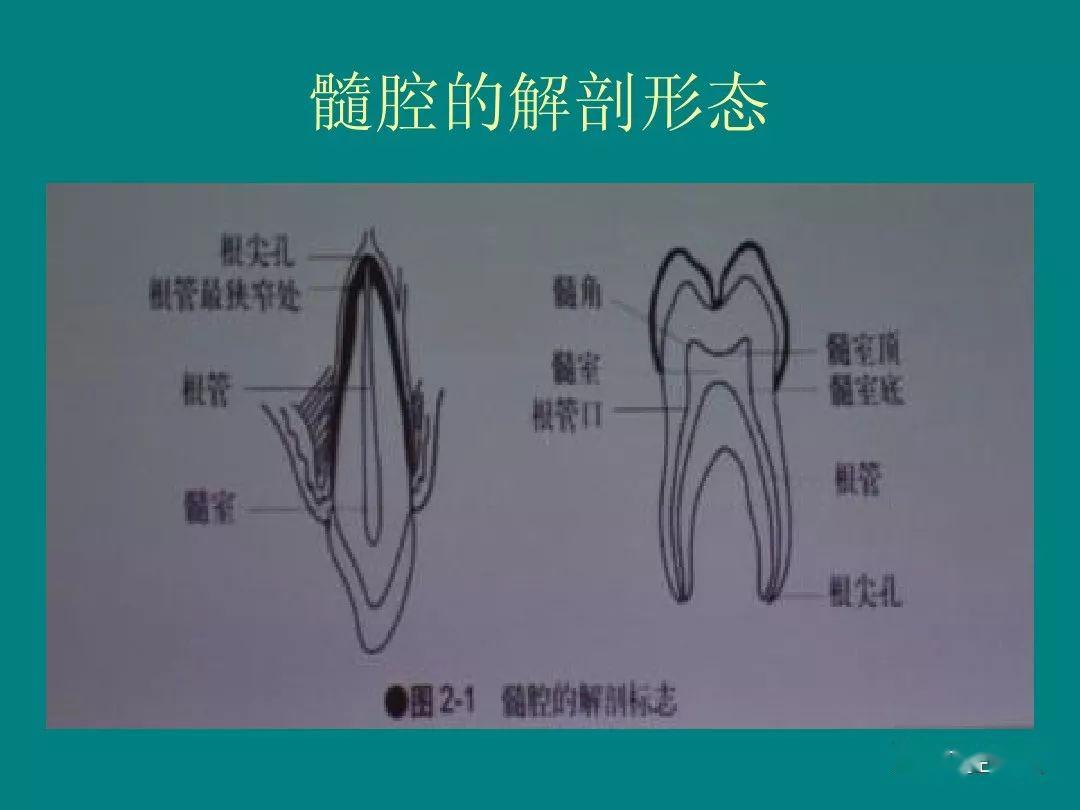 只有胜利者才能用战争去换取和平在与根管的战争中医