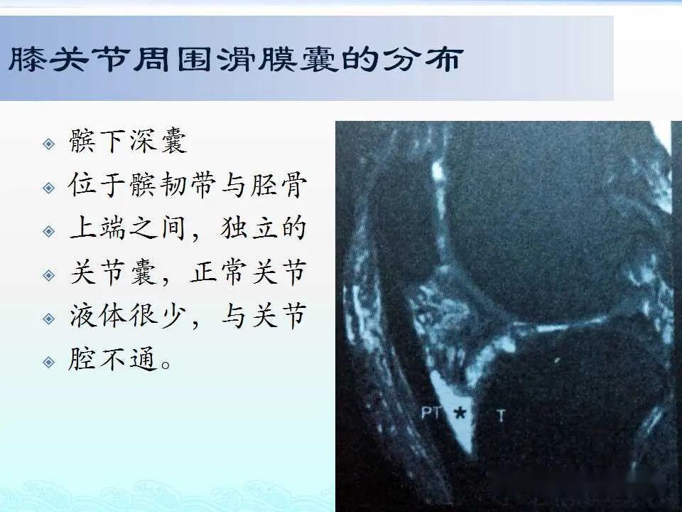 认识这些滑膜囊诊断不再困惑