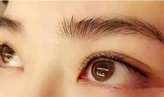 眼部三根线做了美上天