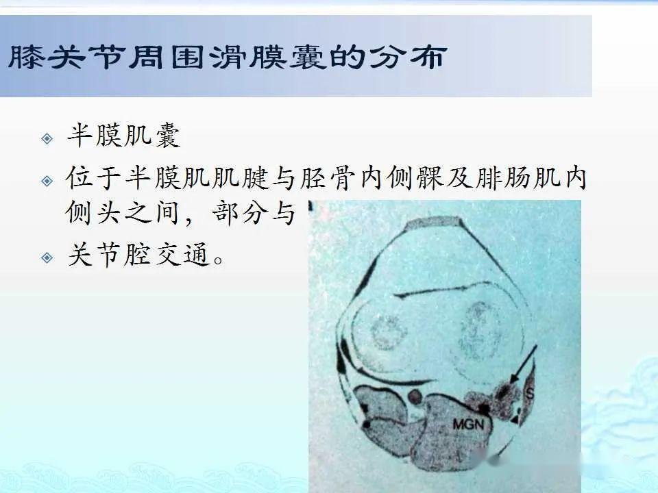 认识这些滑膜囊诊断不再困惑