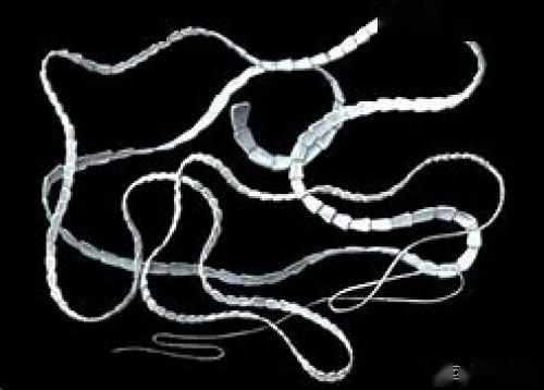 主子体内竟然有这些寄生虫