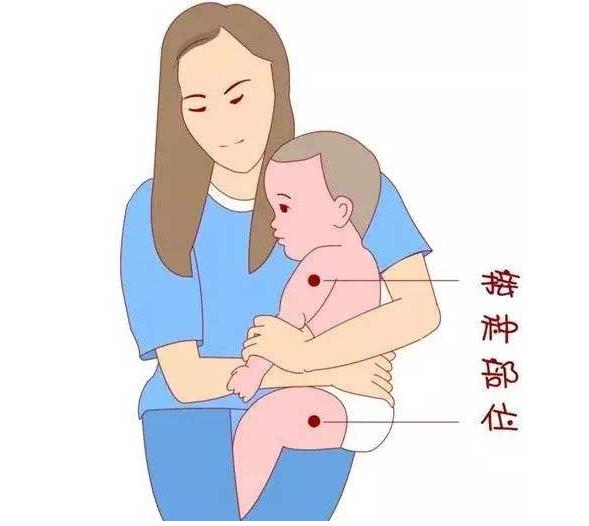婴儿预防针结痂正常图图片