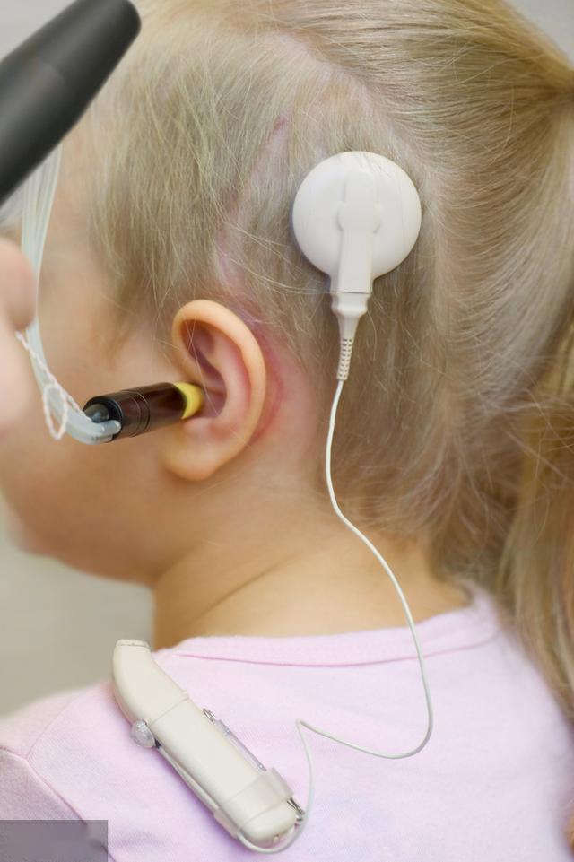 人工耳蜗网提高患者生活质量