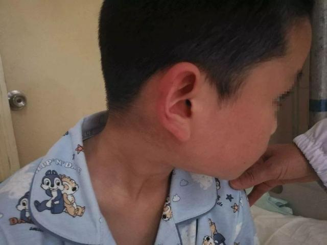 疫情期间这三种儿童传染病都有新冠肺炎相似症状家长们注意