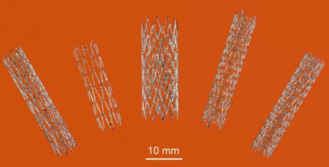 镍钛合金自膨胀血管支架3d打印研发取得新进展