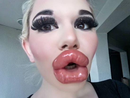 她被称为真人芭比娃娃曾做过20次丰唇注射嘴唇大的像香肠