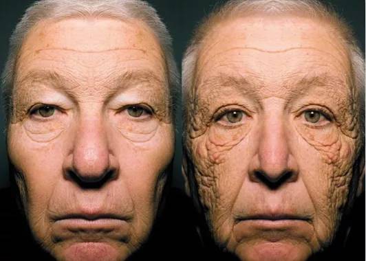 宝政老师初夏如何防止水分流失并且做好晒后修复防止晒黑做个水润嫩白