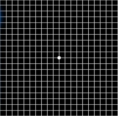 (阿姆斯勒方格表)(视物变形,中心视野缺损)一旦出现上图视物变形,中心