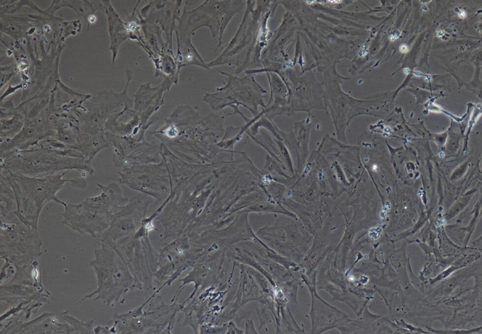 肾足细胞肝实质细胞肝kupffer细胞