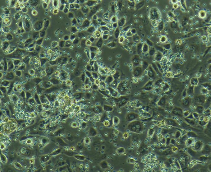 肝实质细胞肝kupffer细胞