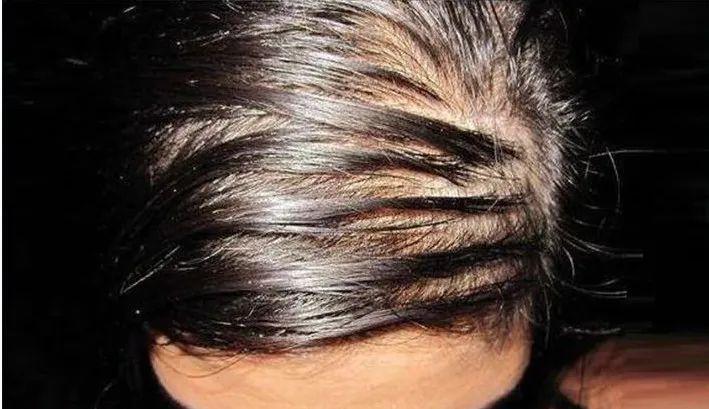 头油,头屑,头痒日复一日,如何才能养护一头秀发?