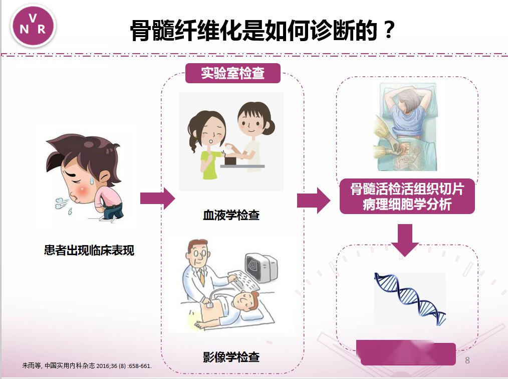 當患者出現臨床表現後,可以通過 血液學檢查,影像學檢查,骨髓活檢