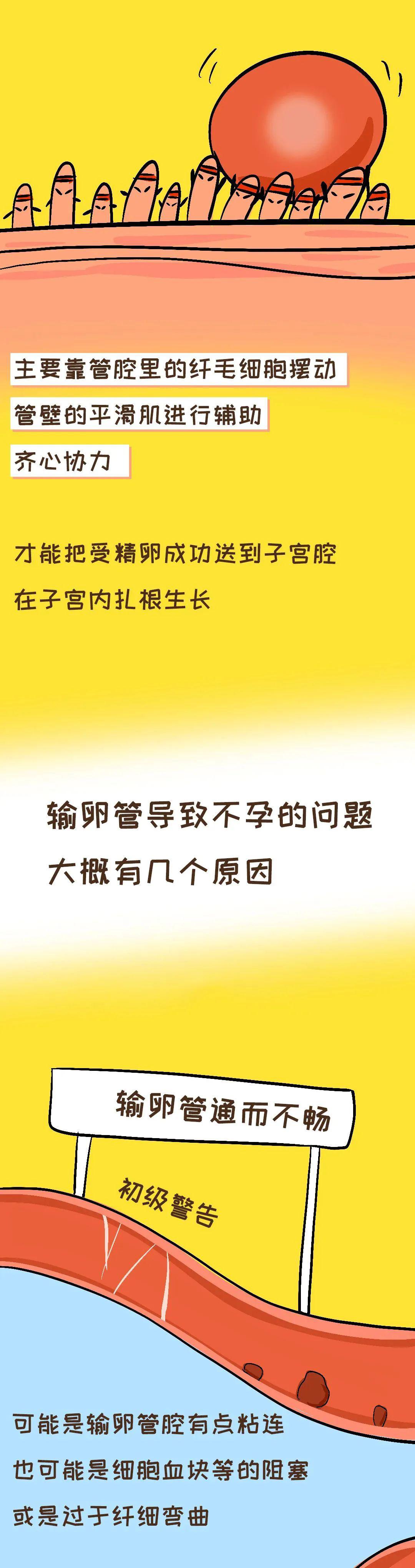 圖解丨輸卵管堵塞的幾種情況