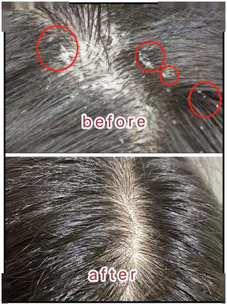 可怕原来你的头发里有这么多螨虫