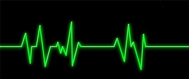 原创心电图真的可以检查出冠心病吗有什么依据今天来告诉各位答案