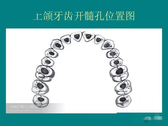 只有胜利者才能用战争去换取和平在与根管的战争中医