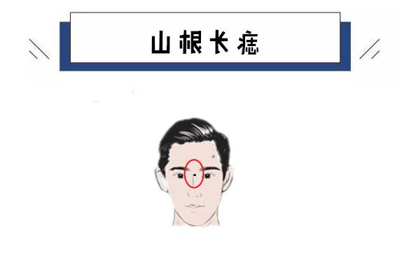 原创男人四颗穷酸痣窝囊靠不住自私脾气大晚年人财两空