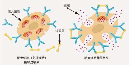 蕁麻疹反覆發作瘙癢難耐太痛苦多是這3個因素在作祟