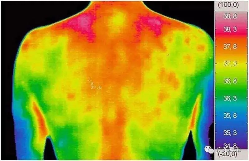 人体内部温度图片