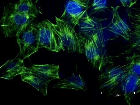 f-actin微丝蛋白研究_染色
