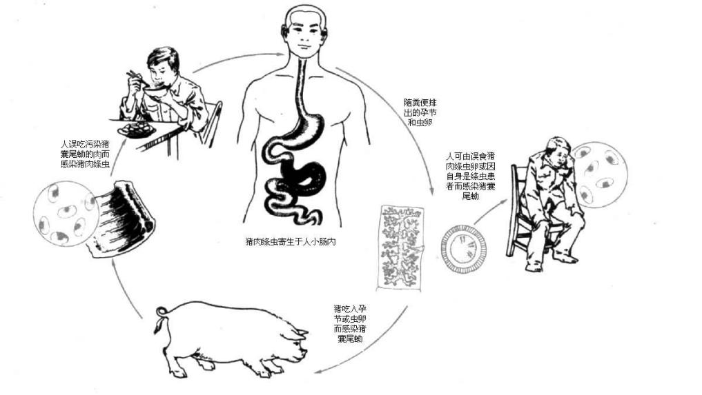 疾病防治透过奥斯卡最佳电影寄生虫的镜头带你了解脑囊虫病的前世今生