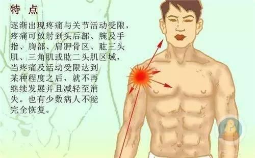 锦章堂丨潍坊列举导致肩膀疼痛的八大常见原因