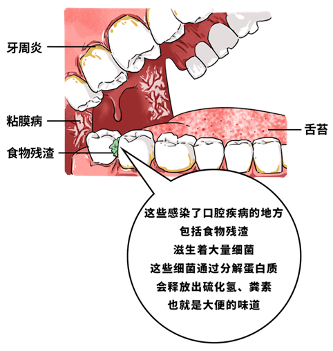 提醒:嘴巴有5种味道,可能是疾病信号_口腔