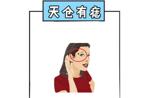 女人5颗"黄金"痣,命中显贵,土鸡变凤凰,千金难买!