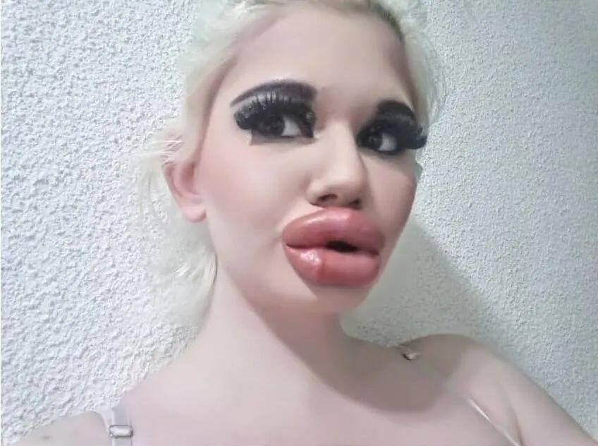 图集世界上最厚的嘴唇你们感受下