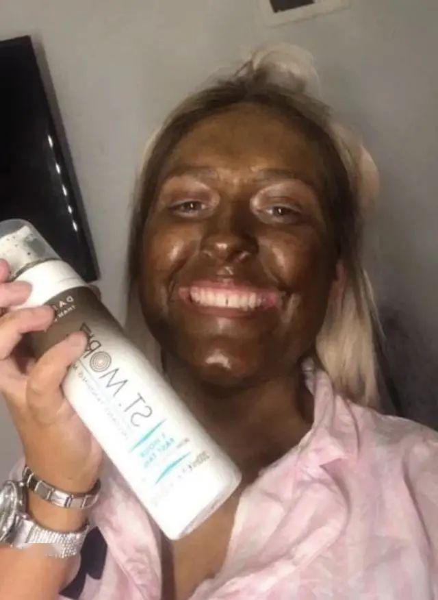 英国女子疫情期无聊用假美黑剂后变成黑人只能用漂白剂泡澡