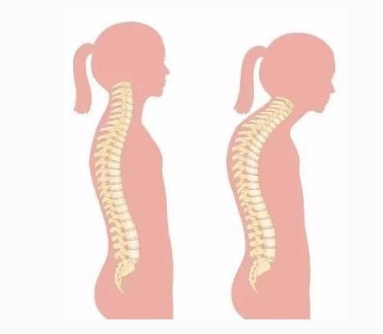 孩子弯腰驼背是怎么造成的不良体型的矫正方法这里告诉您