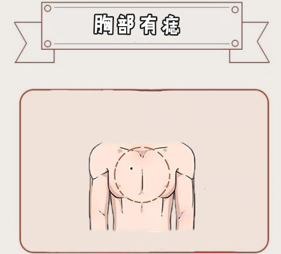 乳房下部有痣图解图片