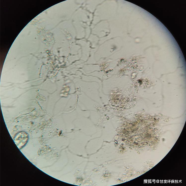 丝状菌丰度图片