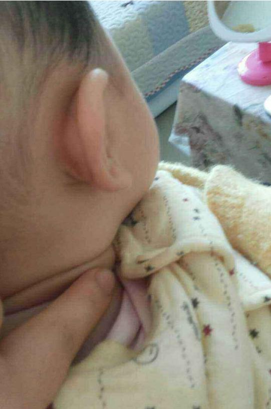 五个月婴儿歪脖子图片图片