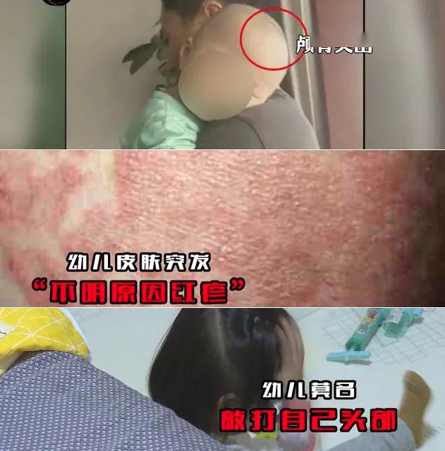 多名婴儿营养不良酷似大头娃娃竟是食用了同款奶粉