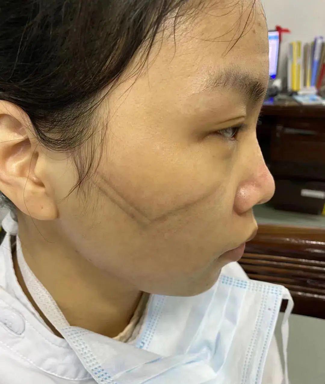 向疫情中的护士们致敬