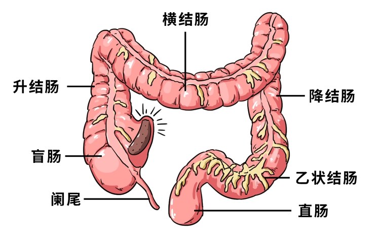 平时多吃2种天然泻剂,让你大便畅通