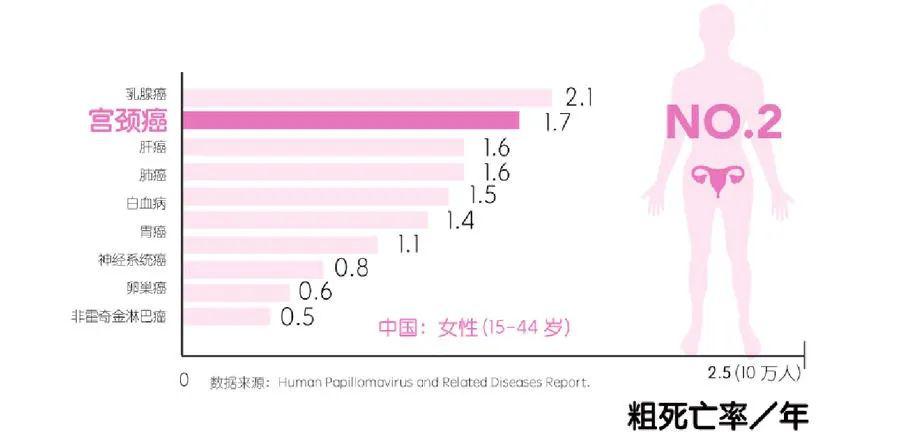 宫颈癌最喜欢的4种女人别忽视它的早期症状